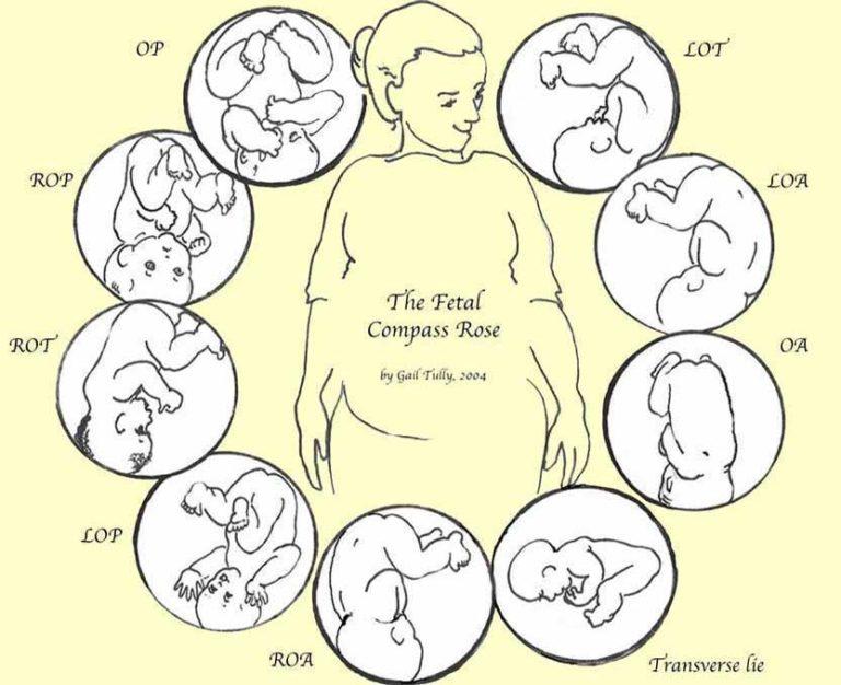 Fetal Positions Compass1 Mamasaurusca 